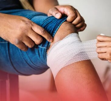 When a Dog Bite Turns Serious: Legal Steps to Take